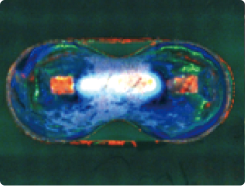 基板外観検査装置 検査項目 DIPブリッジ